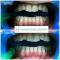 IGIENE DENTALE E SBIANCAMENTO CLICK BLANCONE